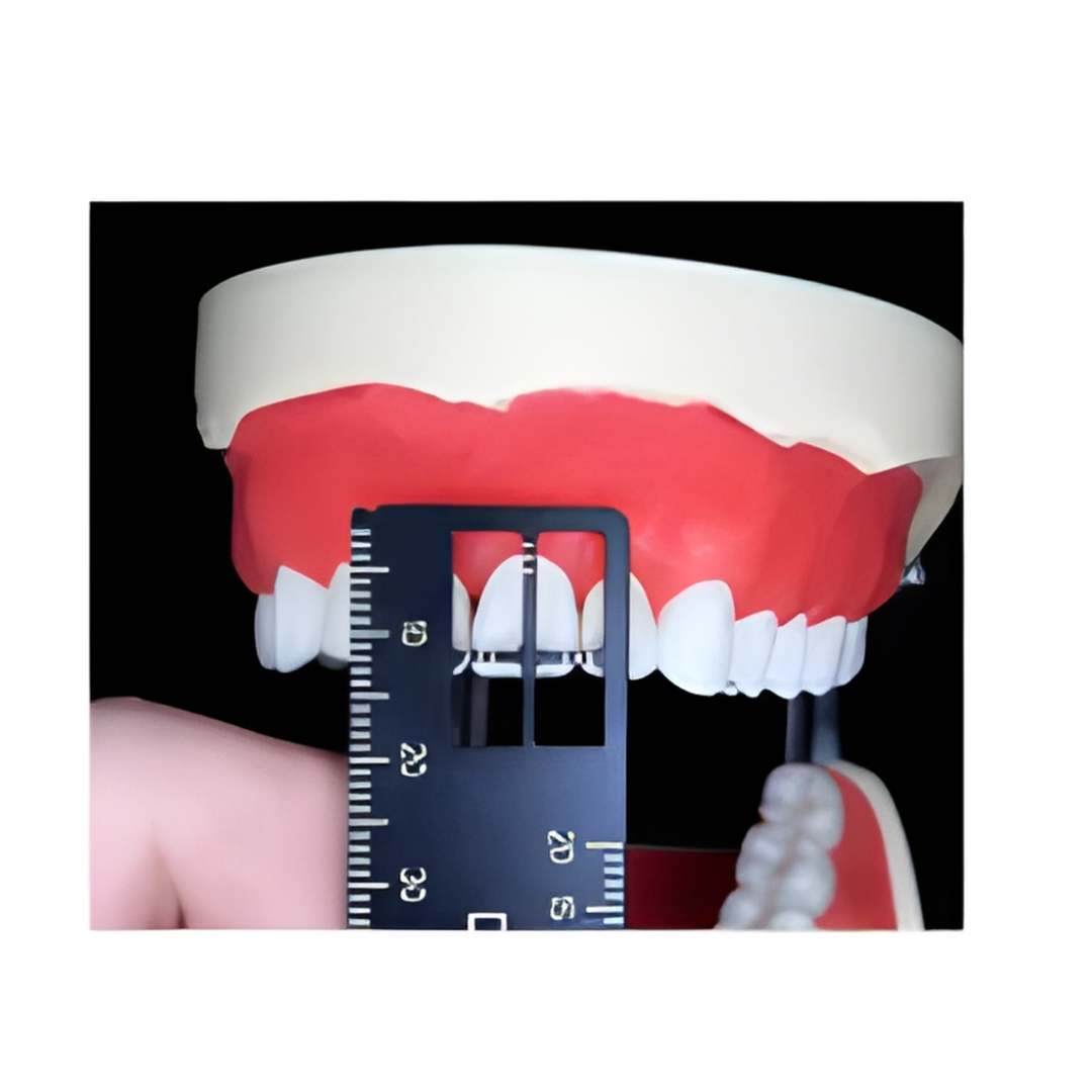 Tooth Meter Dental Ölçüm Cetveli