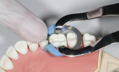 Posterior Kompozit Restorasyonlarda Kullanılan Bölümlü (Sectional) Matriks Sistemleri: Özellikleri ve Klinik Avantajları 